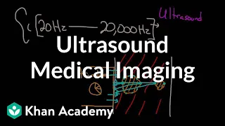 Ultrasound medical imaging | Mechanical waves and sound | Physics | Khan Academy