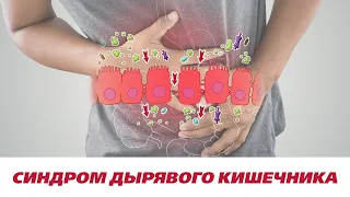 Синдром дырявого кишечника