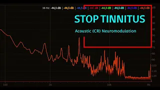 Stop Tinnitus in 30min, Acoustic (CR) Neuromodulation