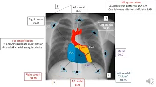 How to read coronary angiography