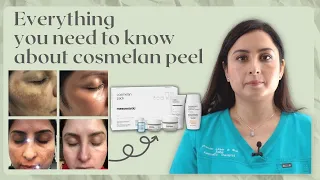 COSMELAN PEEL | SENIOR PRACTITIONER'S GUIDE TO Hyperpigmentation treatment