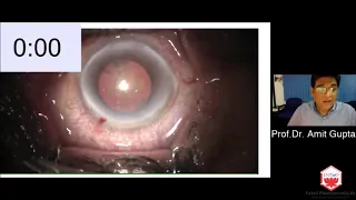 Dr Amit Gupta (PGI, Chandigarh) -  A Presentation on Phenocaine Plus   Chandigarh Ophthalmic Society