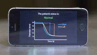 PupilScreen: Using Smartphones to Assess Traumatic Brain Injury