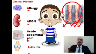 Henoch- Schonlein purpura (HSP)   #cme #internal_medicine #medical #usmle #محاضرات_باطنة #USMLE