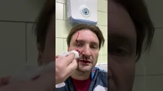 На Эдгара Запашного напал тигр и серьезно повредил ему лицо