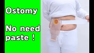 How to use two piece ostomy bag