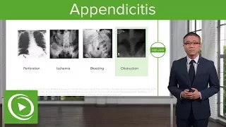 Acute Abdomen, Appendicitis & Peritonitis – General Surgery | Lecturio