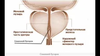 Случай № 37 Хронический колликулит, простатит. Хронический болевой синдром. Часть 2