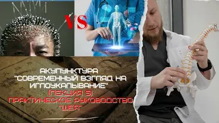 Иглорефлексотерапия. Современный взгляд на иглоукалывание