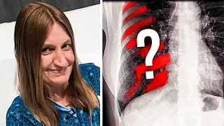 Woman Has Something Strange Growing Behind Ribs