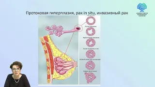 Доброкачественные заболевания молочной железы | Алгоритм диагностики и лечения