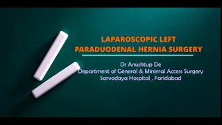 LAPAROSCOPIC LEFT PARADUODENAL HERNIA SURGERY