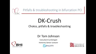 DK-Crush: Choices, pitfalls & troubleshooting - Dr Tom Johnson