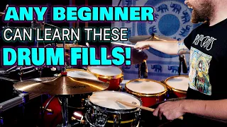 DRUM LESSON: 5 Drum Fills Perfect For BEGINNER Drummers