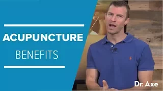 Acupuncture Benefits to Improve Your Health