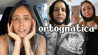 FIZ UMA CIRURGIA NA MANDÍBULA - PRÉ & PÓS OPERATÓRIO