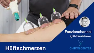 Hüftschmerzen seitlich mit Ausstrahlung ins Bein, woher kommt das? Was kannst Du tun?