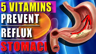 5 Vitamins That Naturally Prevent Acid Reflux To Teep You Healthy