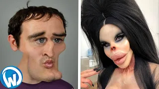 People Who Abused Plastic Surgery