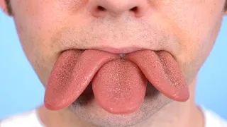GROWING EXTRA TONGUES!