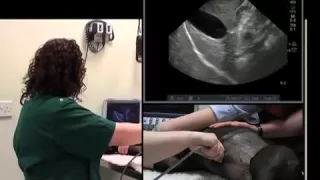 IMV imaging Abdominal Ultrasound Video 4 - Ultrasound exam of the liver