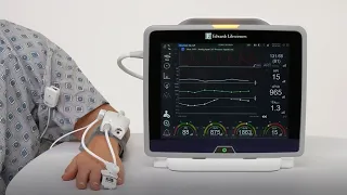 Acumen IQ cuff and sensor setup on HemoSphere monitor with Release 7