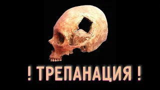 Трепанация черепа [Бояршинов и Алипов]