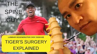 Lumbar  Degenerative Disc Disease : Part 3: Surgical Treatments, The "Tiger Woods" Surgery.