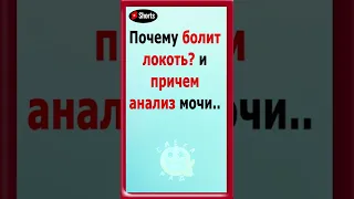 Почему болит локоть и причем анализ мочи #анекдот#анекдотпро#смешнойанекдот