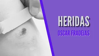 REFLEXIONES - Óscar Fradejas | #14 Heridas - MENSAJES DE ÁNIMO