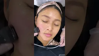 Nadine Lustre | AIVEE BEVERLY HILLS LIFT