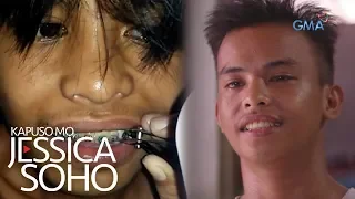 Kapuso Mo, Jessica Soho: Peligrosong DIY braces