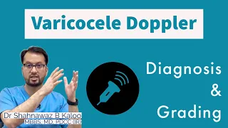 Varicocele Grading and Diagnosis by Doppler Ultrasound. Dr Shahnawaz B Kaloo.
