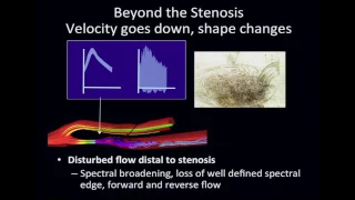 Peripheral Vascular Disease ultrasound