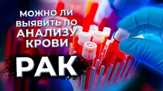 Анализ крови на РАК