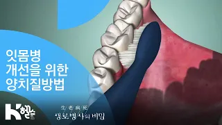 잇몸병 개선을 위한 양치질방법 - (20181114_670회 방송) 3분의 힘, 잇몸병 개선 프로젝트