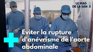 L'anévrisme de l'aorte abdominale - Le Magazine de la Santé