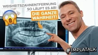 Weisheitszahnentfernung - So läuft es ab! Und wann müssen Weisheitszähne wirklich raus?