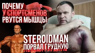 СТЕРОИДМЕН КАК РВУТСЯ МЫШЦЫ и СУХОЖИЛИЯ (Жим штанги)