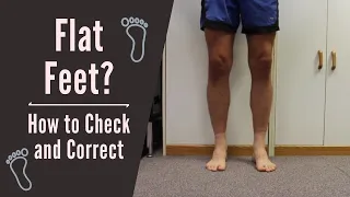 Flat Feet: How to Check and Correct