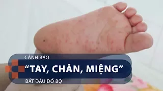 Cảnh báo: “Tay, chân, miệng” bắt đầu đổ bộ | VTC1