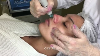 Как готовилась к свадьбе Мария Мельникова в ЦИДК. Этап 1. Очищение кожи HydraFacial