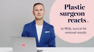Plastic Surgeon Reacts to Women’s Real Buccal Fat Removal Experiences & Results