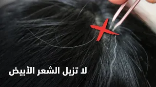 لماذا نهانا الرسول ﷺ عن إزالة الشعر الأبيض من الرأس !