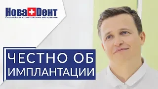 🔵 Все стороны имплантации зубов - плюсы и минусы. Имплантация зубов плюсы и минусы. НоваДент. 12+