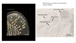 Lecture-137: Oral and Mucocutaneous Candidiasis. Rook's chapter 32.