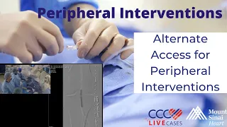 Alternate Access for Peripheral Interventions - August 15, 2018