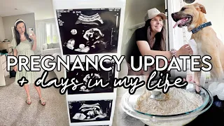 VLOG: anatomy scan, pregnancy updates, zac's birthday + days in my life