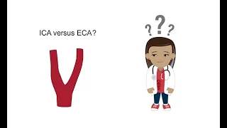 Distinguishing the ICA from the ECA with ultrasound