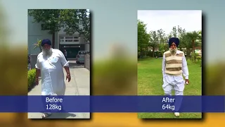 Life after losing 64 Kg with Bariatric Surgery| Mini Gastric Bypass|India |Dr. K S Kular